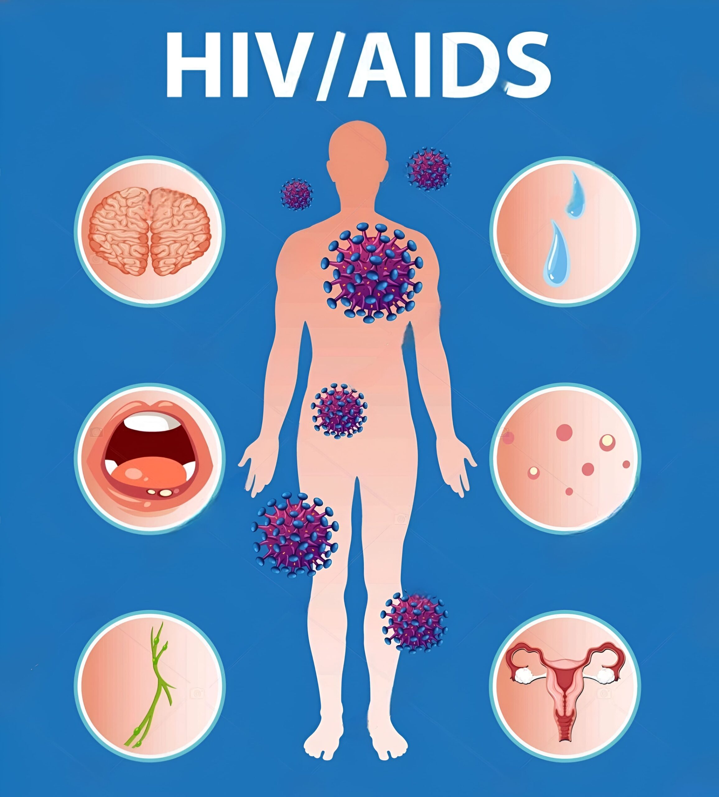 HIV/AIDS - ilustração